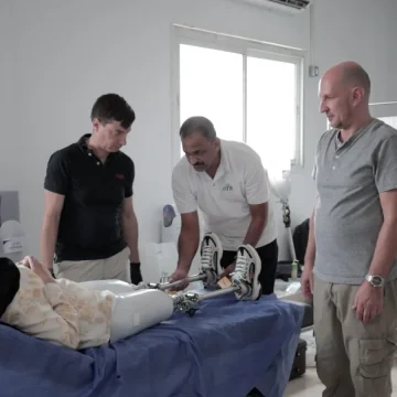 UAE field hospital begins fitting prosthetics for Palestinian wounded